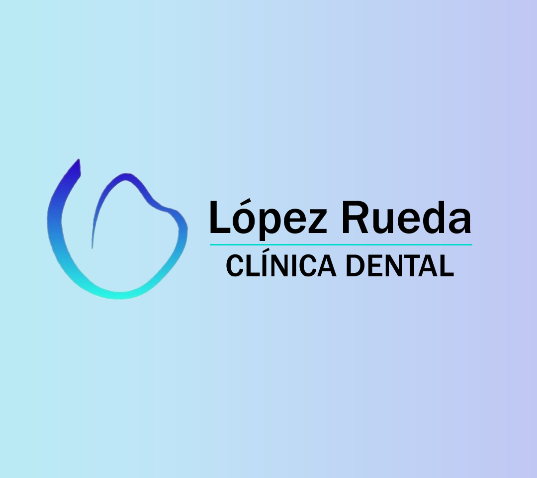 dentistas en Madrid López Rueda
