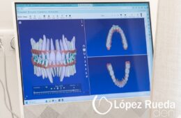 Ortodoncia en adultos: nunca es tarde para alinear tu sonrisa