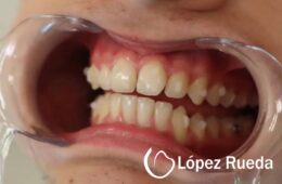 Beneficios de la ortodoncia más allá de la estética