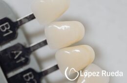 Dientes más blancos, sonrisa más segura